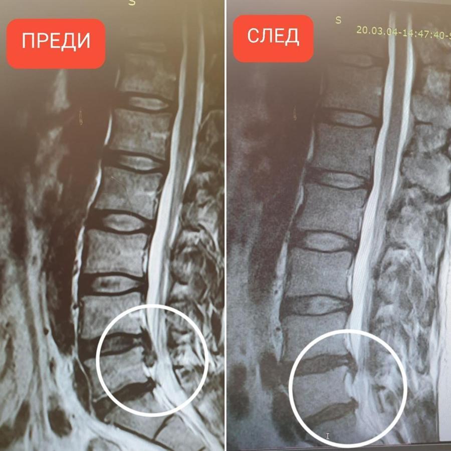 Hotel-Clinic Dr. Gechevi Pavel Banja Exteriör bild